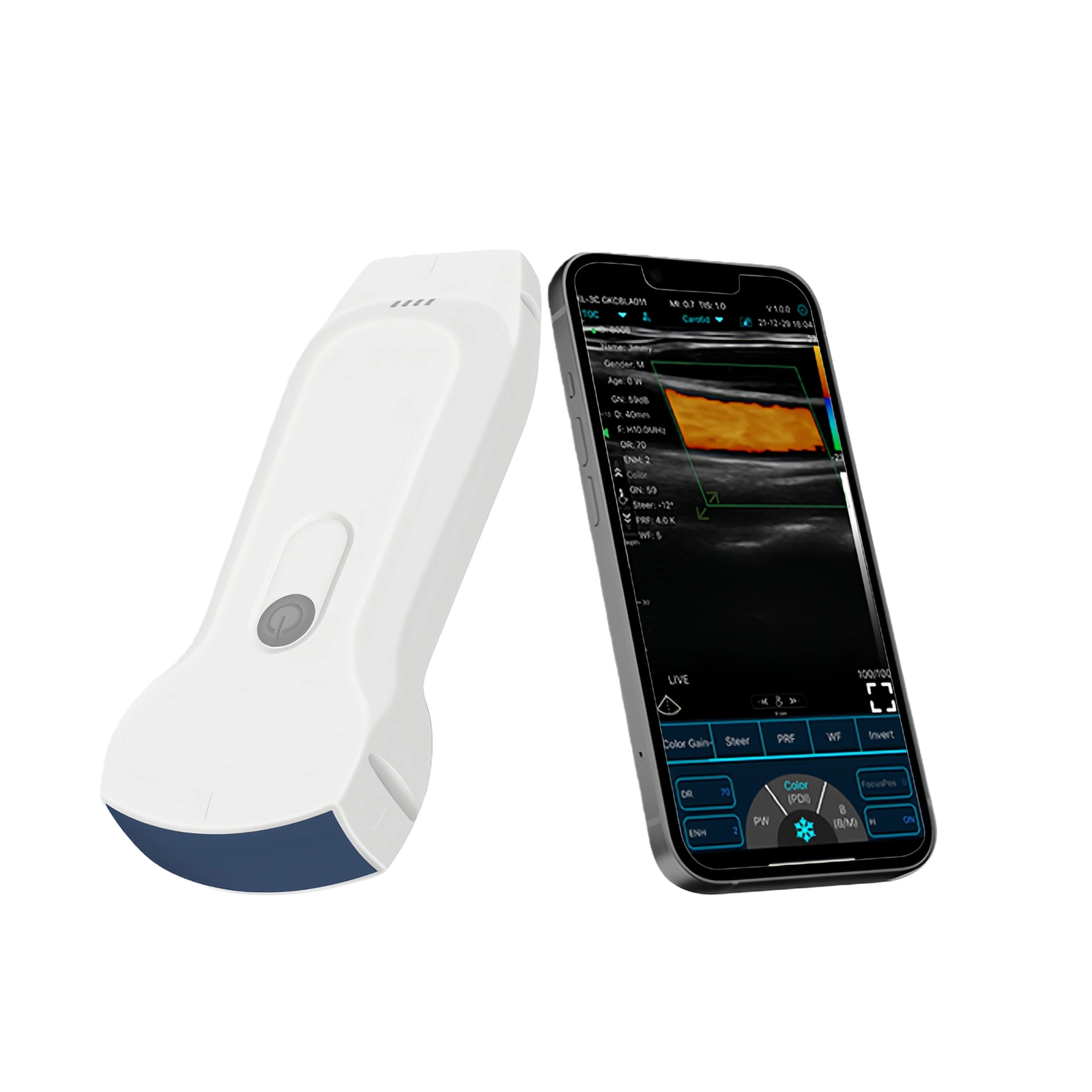 Dual Probe Portable Handheld Wireless/USB Ultrasound Scanner
