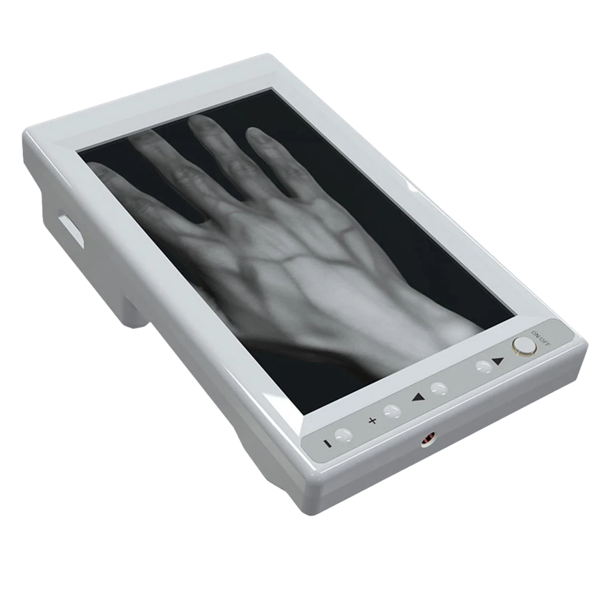Handheld Ultrasound Scanners: Why every ER nurse needs portable imaging for standard venipuncture.