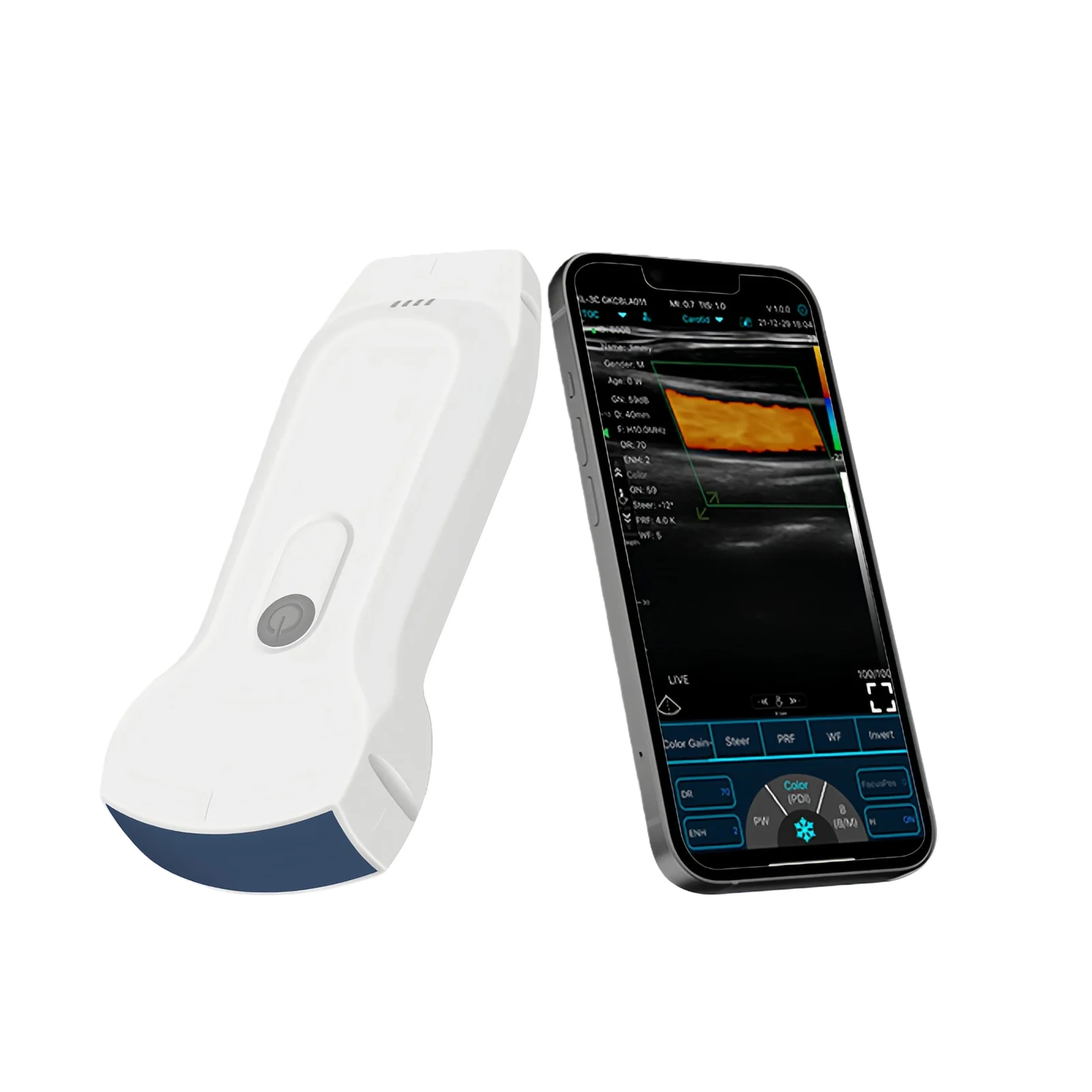 Handheld Ultrasound Scanners: Why every ER nurse needs portable imaging for standard venipuncture.